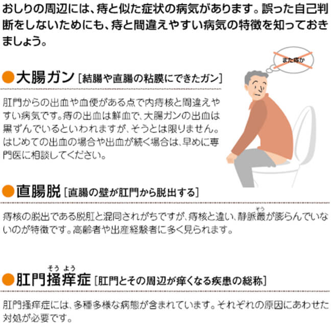 痔と似た症状の病気のイメージ図