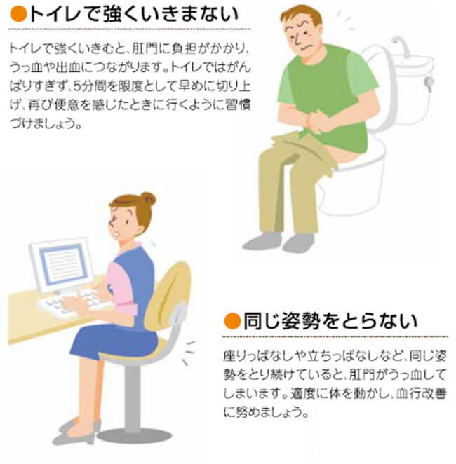 痔の発症・再発を防ぐポイントのイメージ図2