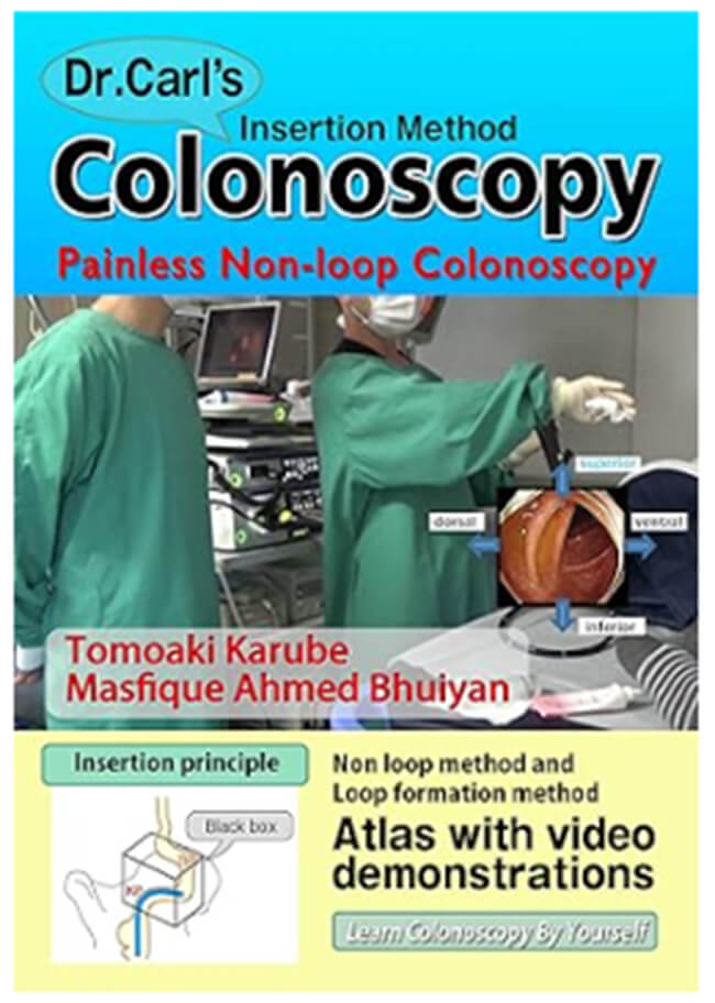 Dr.Carl's Insertion Method Colonoscopy